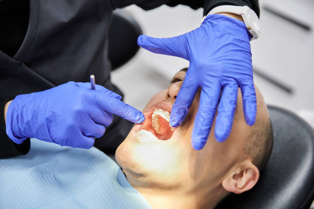Best Emergency Tooth Extraction in Duluth, GA